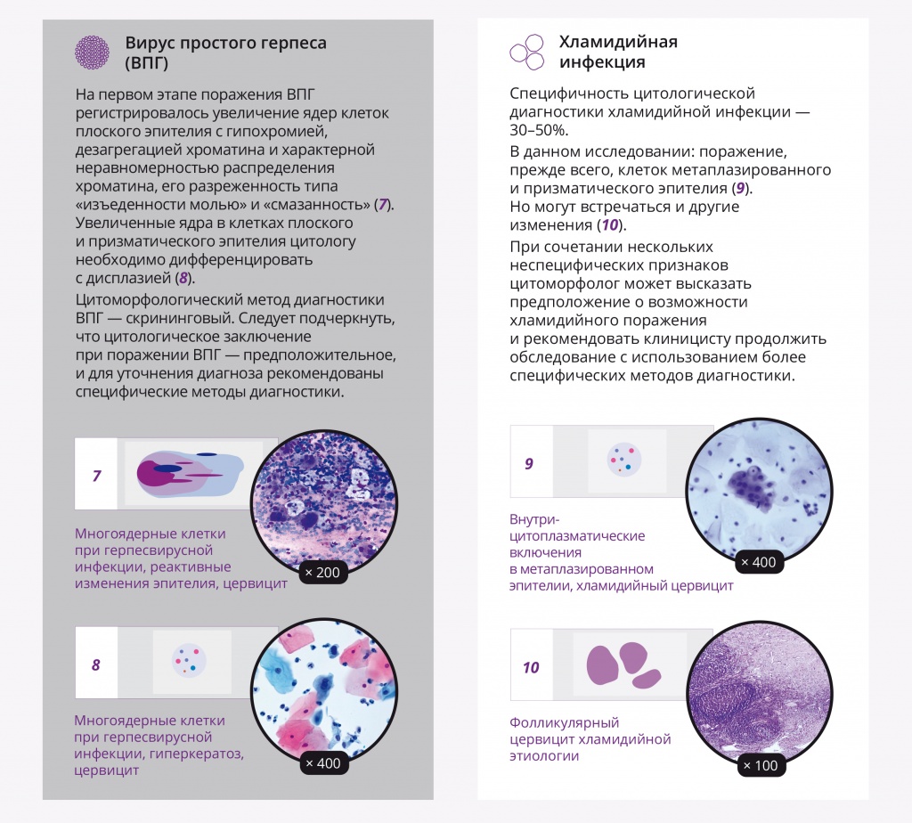 infographics_DoctorRu_vol22_No5_2023_Cytomorphological_Diagnostics-3.jpg