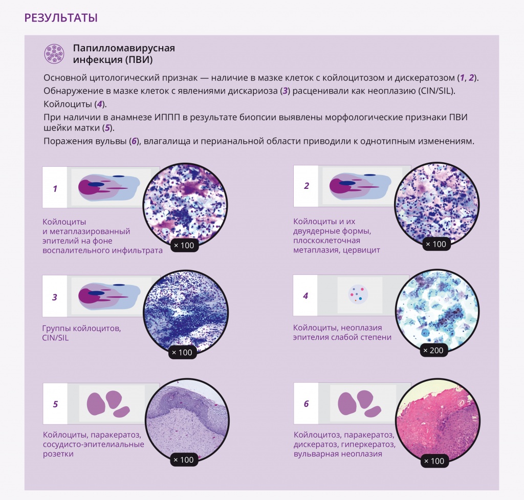 infographics_DoctorRu_vol22_No5_2023_Cytomorphological_Diagnostics-2.jpg
